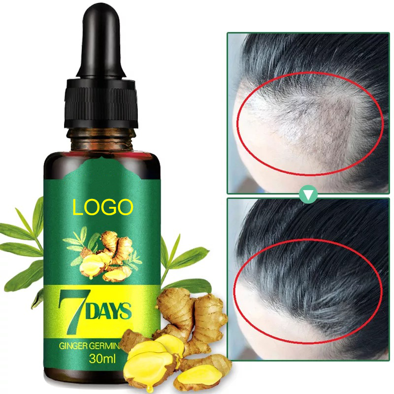 Ready to Ship Private Label Men's Ginger Germinal Serum Oil Anti Hair Loss Treatment Hair Growth Oil from China supplier