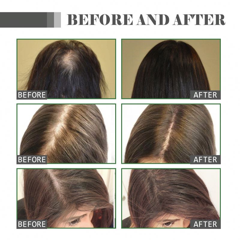 Private Label  Hair Care Essence Scalp Massage Serum Moisturizing Supple Plump and Nutritious Hair Care for Hair Growth from China supplier