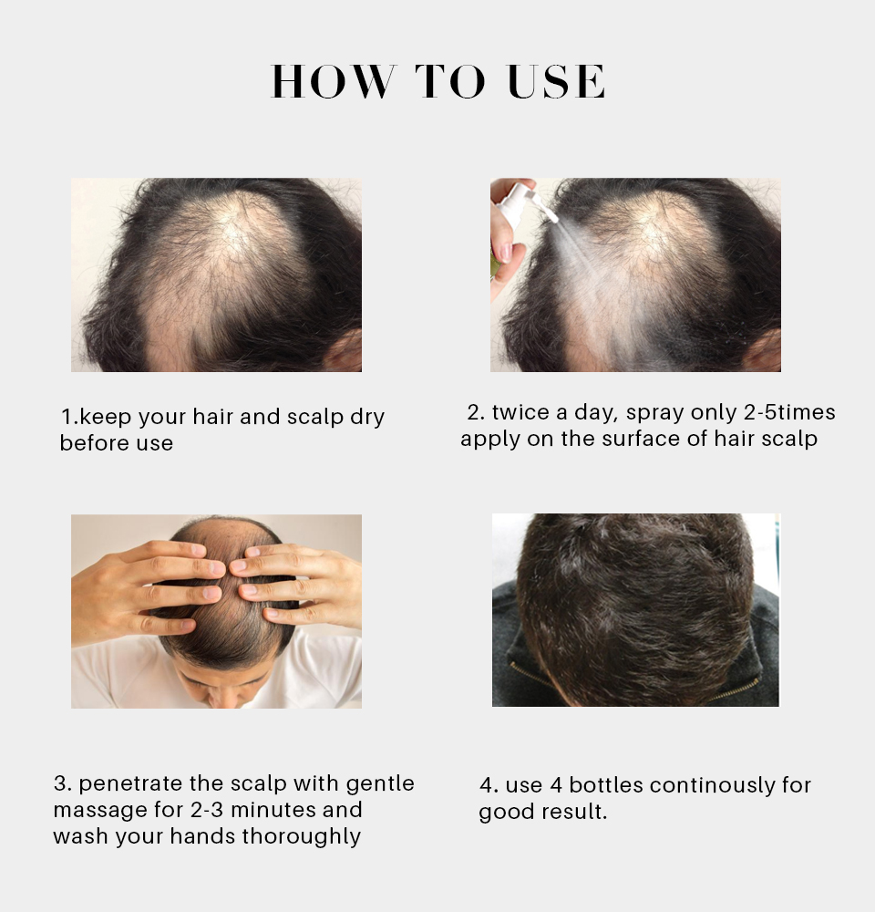 Ginger Liquid Spray for Women Men Regrowth Anti Hair Loss Oils for Hair Growth Hair Growth Intensive Spray from China supplier