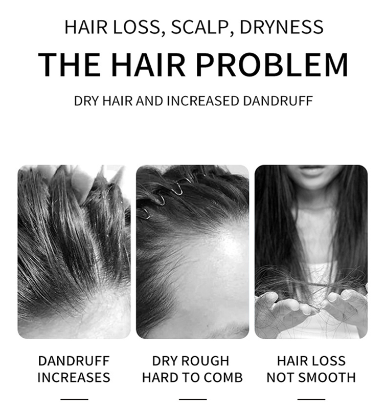 Ginger Orgainc Natural Shampoo Conditioner Anti Hair Loss Hair Care Sets for Repairing from China supplier