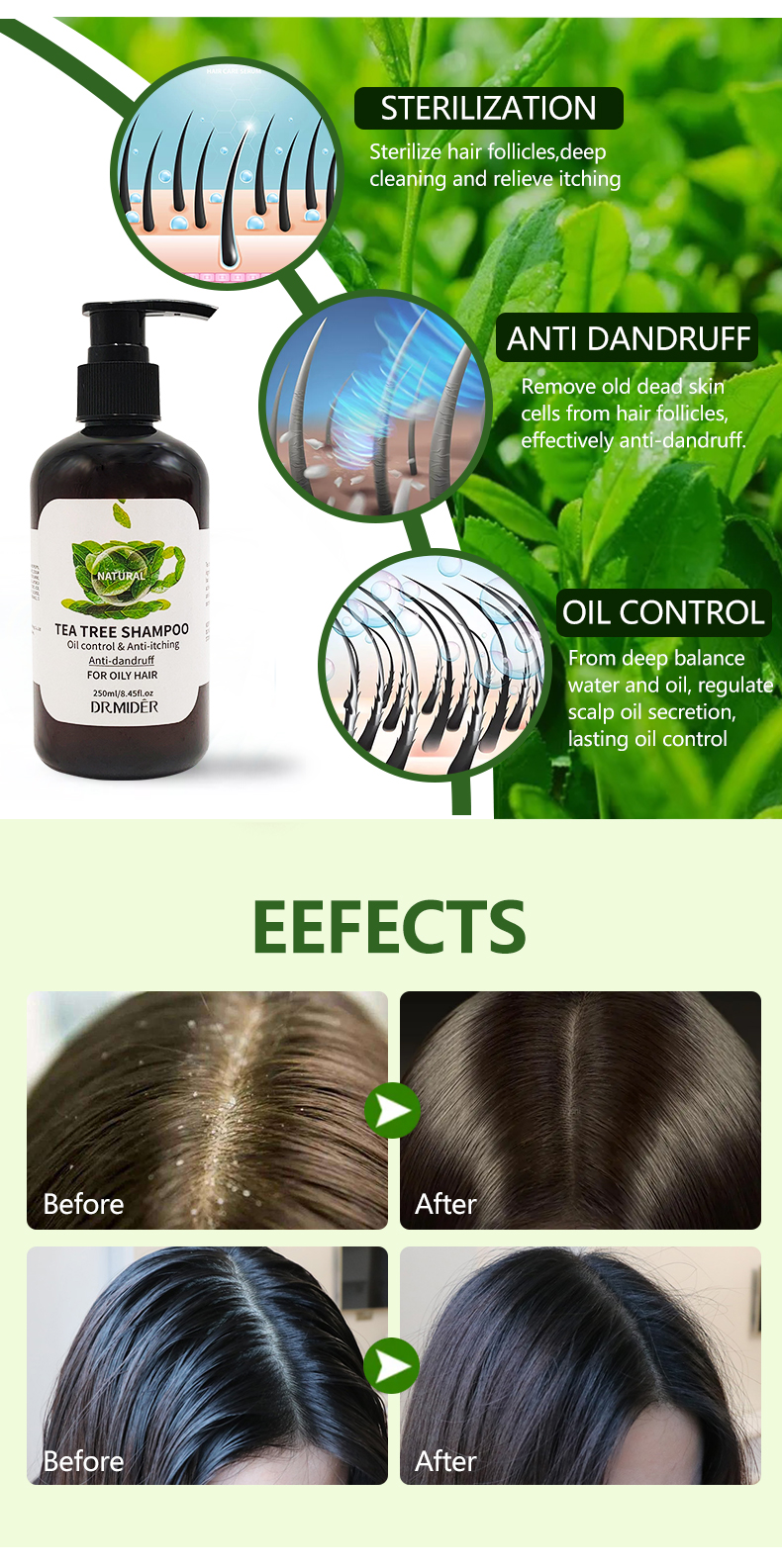 Organic Vegan Paraben Oil Control Free Anti Inflammatory Dandruff Tea Tree Oil Anti Hair Loss Shampoo from China supplier