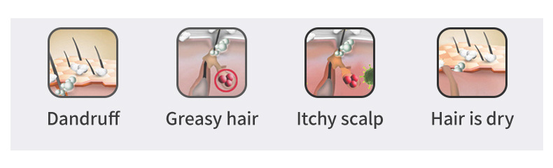 Private Label Organic Ginger Hair Regrowth Shampoo Bar Pure Plant Handmade Soap 16 Flavours Anti Hair Loss Oil Shampoo Soap from China supplier