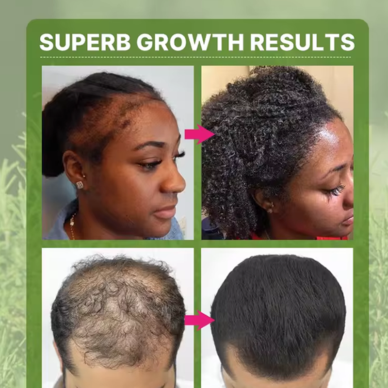 Wholesale Hair Conditioner Shampoo Set Nourishing Repair Rosemary Hair Treatment Set from China supplier