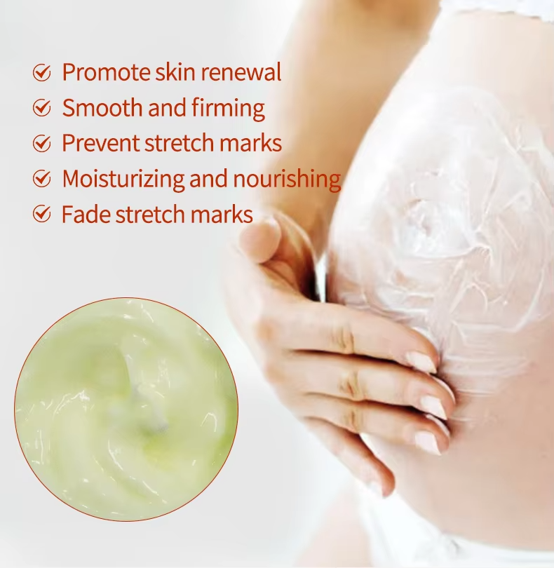 High Quality Powerful Stretch Marks Remover Skin Repair Cream Treatment Scar Removal Pregnancy Cream Adults GMP Moisturizer 1pcs from China supplier