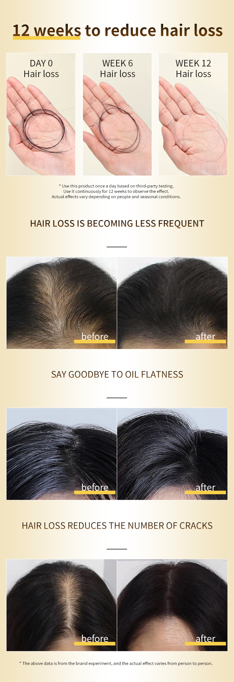 Factory Direct 500ml Herbal Hair Shampoo Hair Loss Treatment Shampoo Organic Turmeric Hair Loss Products from China supplier