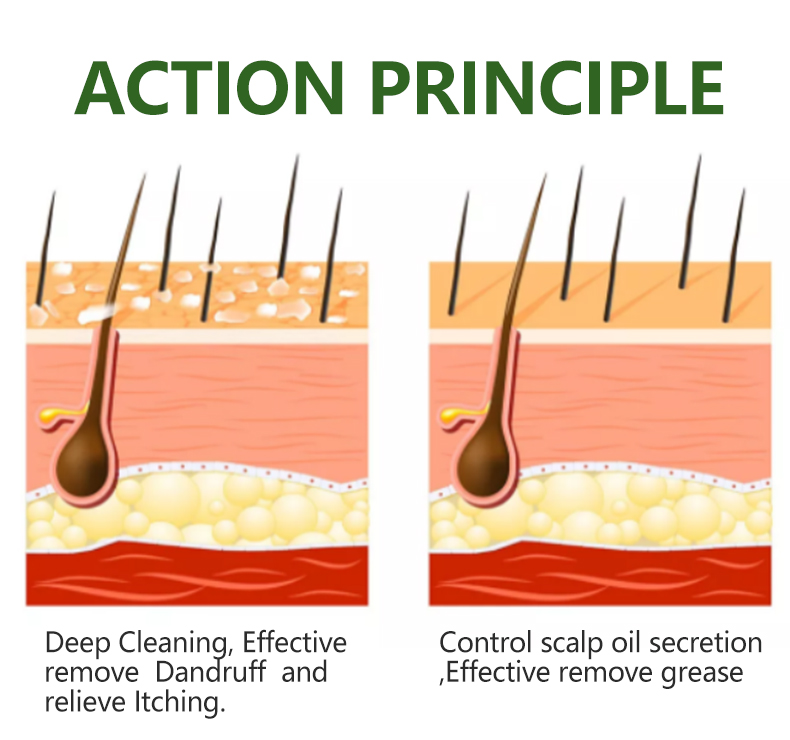 Organic Vegan Paraben Oil Control Free Anti Inflammatory Dandruff Tea Tree Oil Anti Hair Loss Shampoo from China supplier