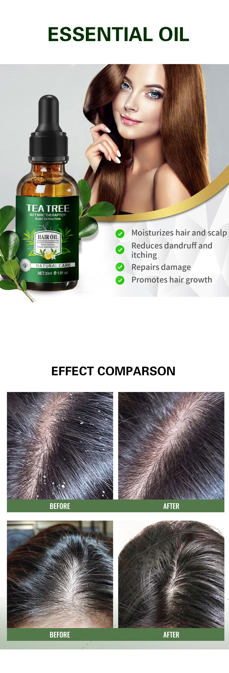 Private Label Beauty Natural Organic Hair Loss Tea Tree Oil Control Anti-Dandruff Shampoo and Conditioner Hair Loss Products from China supplier