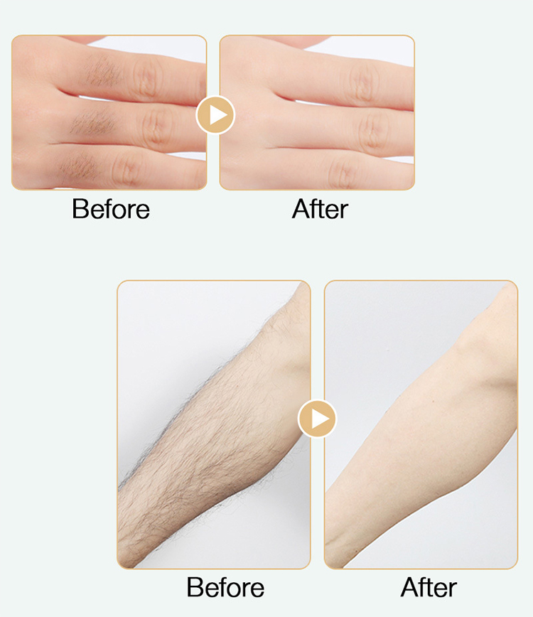 Factory Whole Sale 20ML Powerful Permanent Painless Hair Removal Stop Hair Growth Inhibitor from China supplier