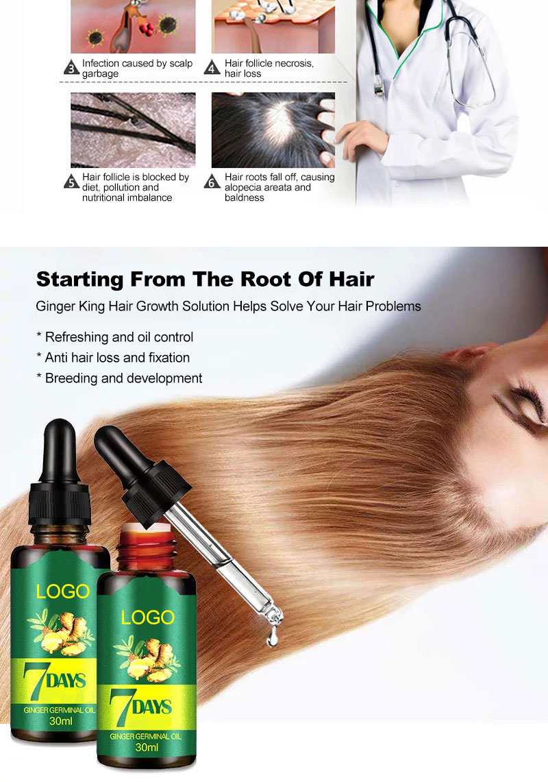 Ready to Ship Private Label Men's Ginger Germinal Serum Oil Anti Hair Loss Treatment Hair Growth Oil from China supplier