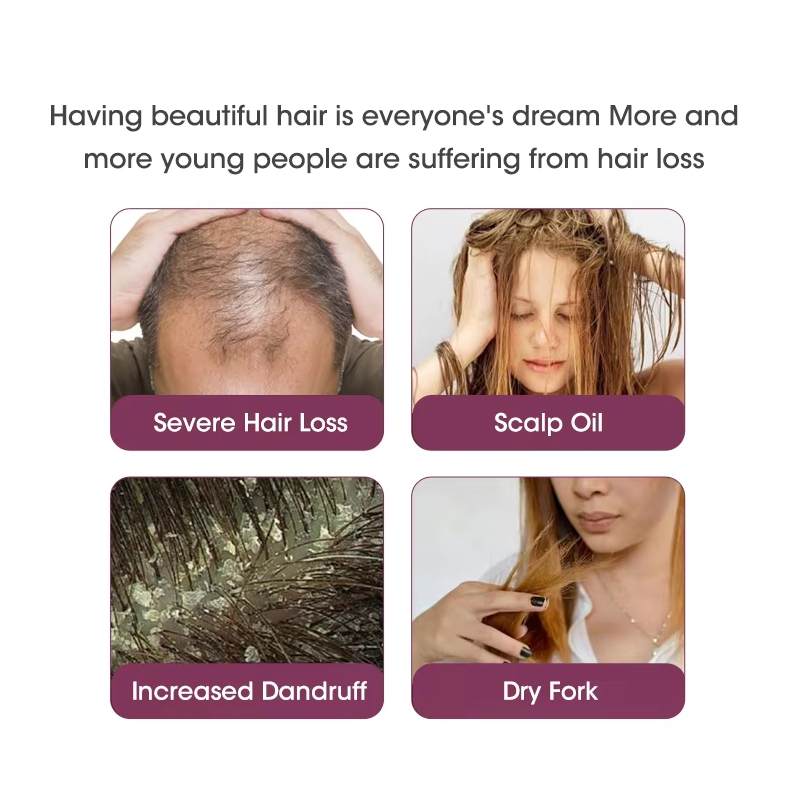 Oem Private Label Anti-Loss Hair Care Women'S Onion Shampoo and Conditioner Set from China supplier