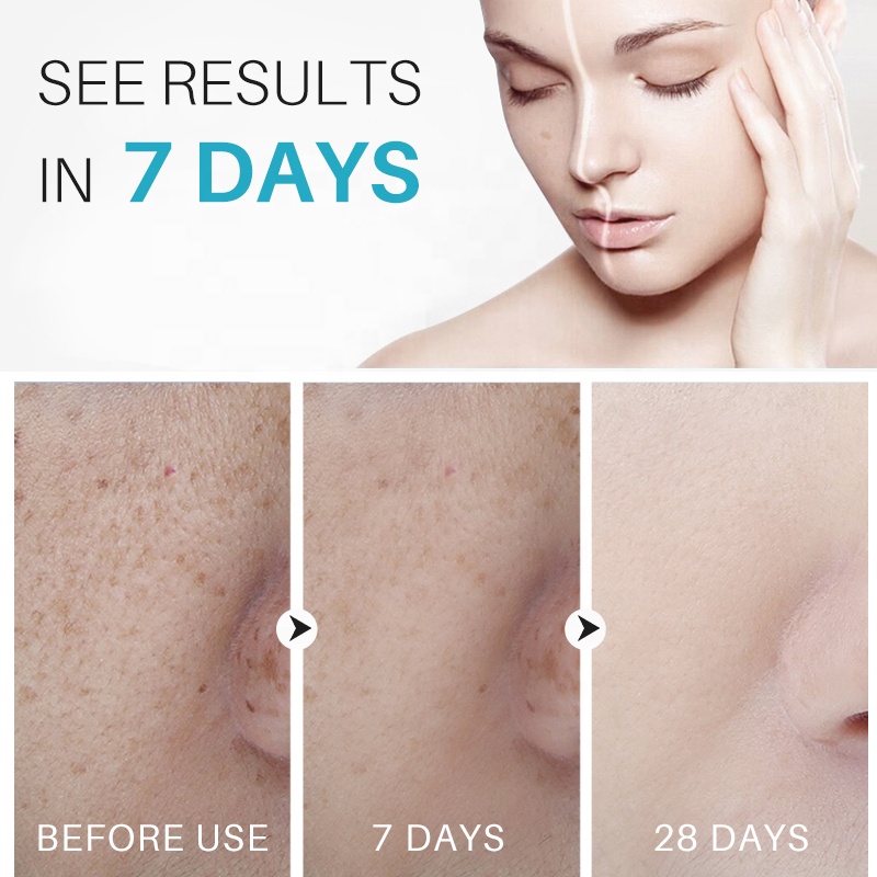 OEM Custom Natural Herbal Blemish Serum Freckle Pimples Dark Spot Removal Corrector  Repairing Whitening Face Cream from China supplier