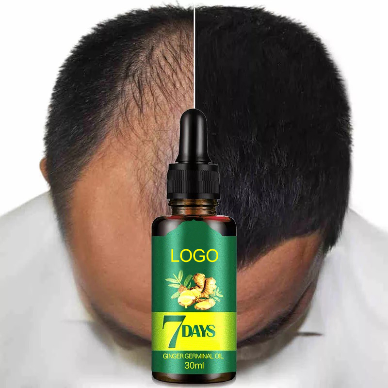 Ready to Ship Private Label Men's Ginger Germinal Serum Oil Anti Hair Loss Treatment Hair Growth Oil from China supplier