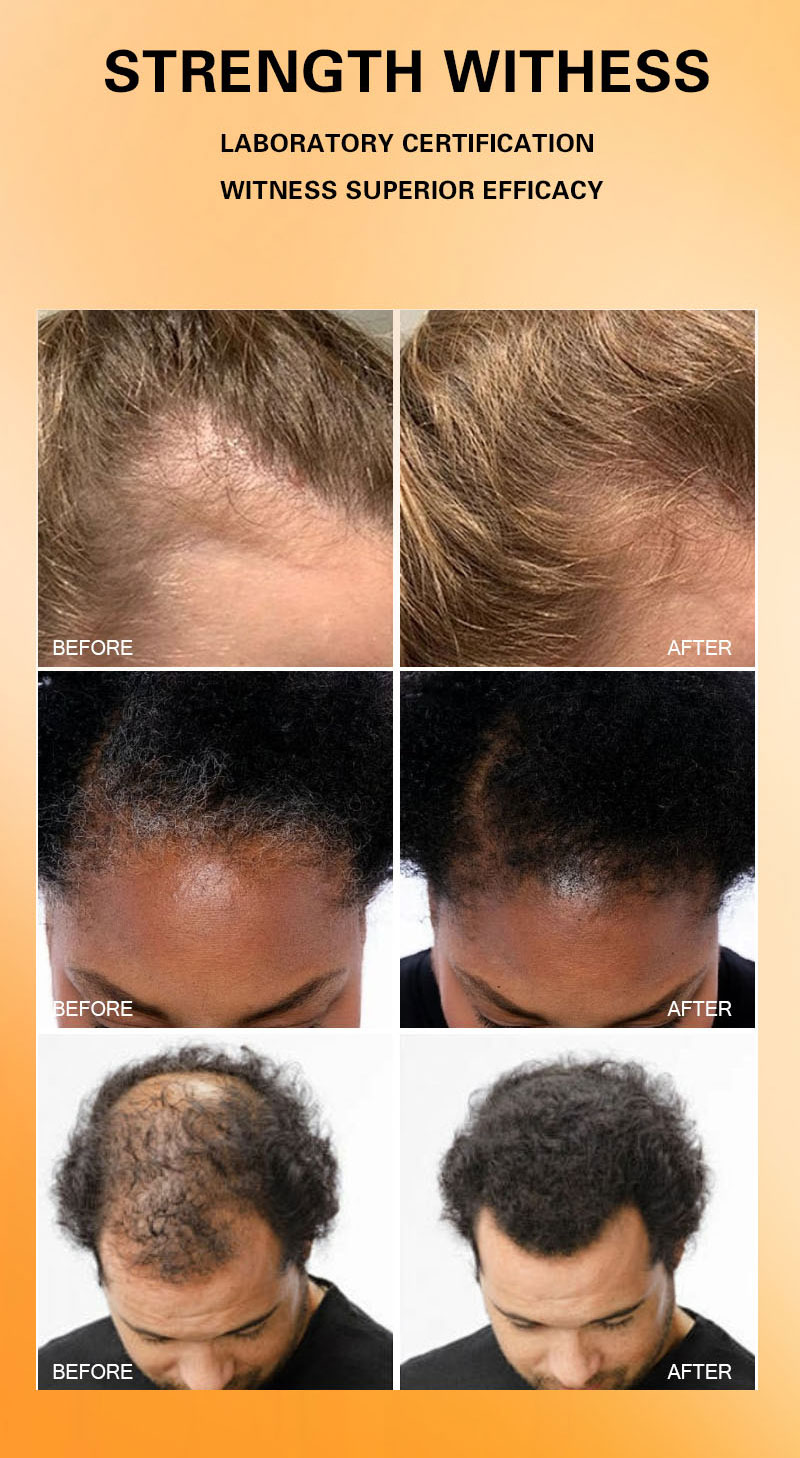 Private Logo Batana Oil Hair Growth Serum Shampoo Hair Mask Set for Thicker Fuller Healthier Hair Loss Products from China supplier