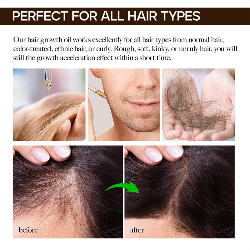 Private Label Hot Sale Products Factory Wholesale Natural Anti Hairloss Serum Organic Hair Growth Oil from China supplier