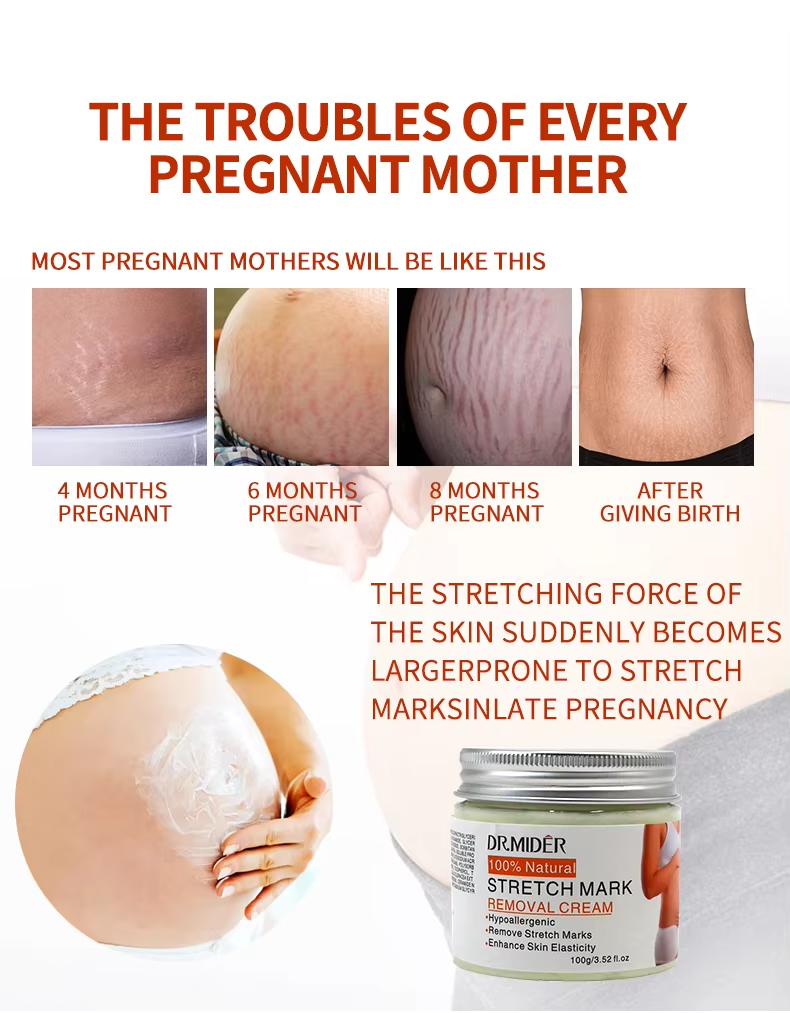 High Quality Powerful Stretch Marks Remover Skin Repair Cream Treatment Scar Removal Pregnancy Cream Adults GMP Moisturizer 1pcs from China supplier
