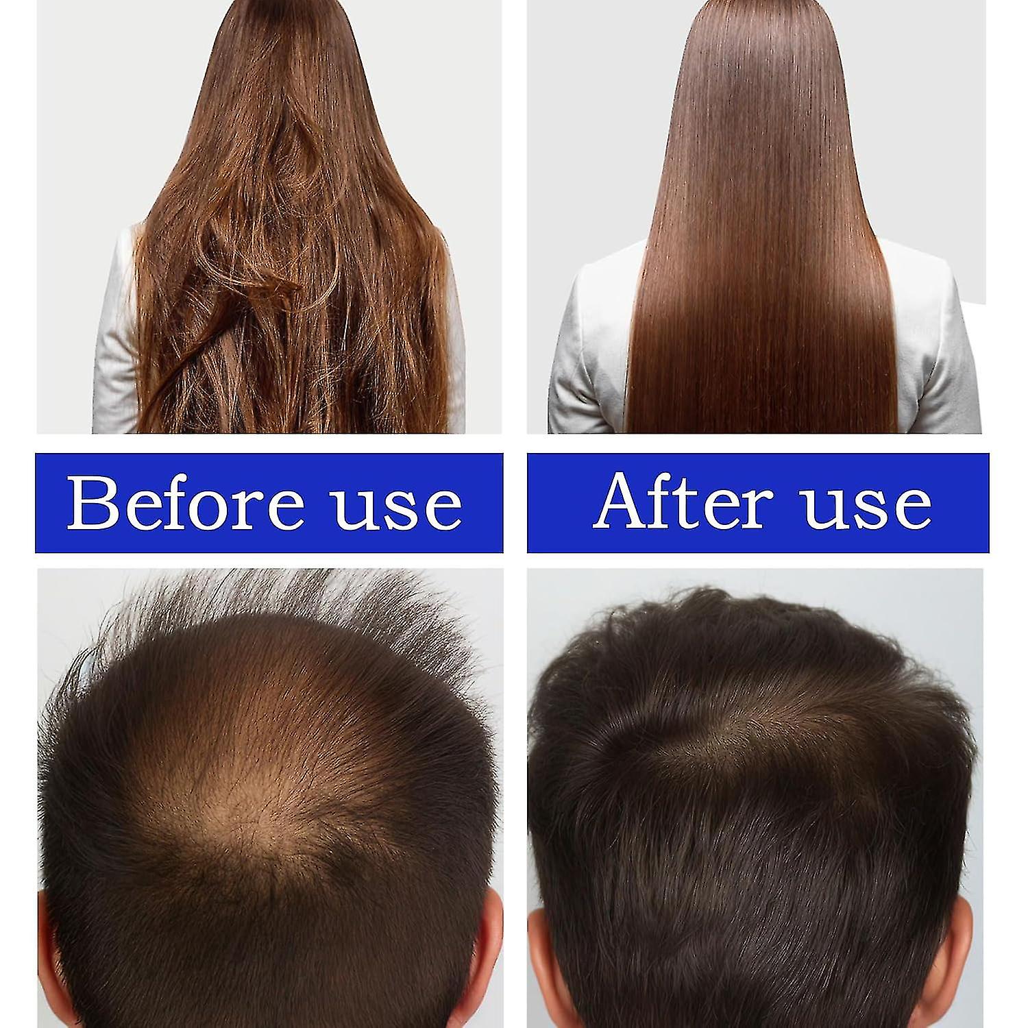 Private Label Vegan Pure 100% Natural Repair Treatment Growth Top Hair Scalp Care Organic Batana Oil for Hair from China supplier