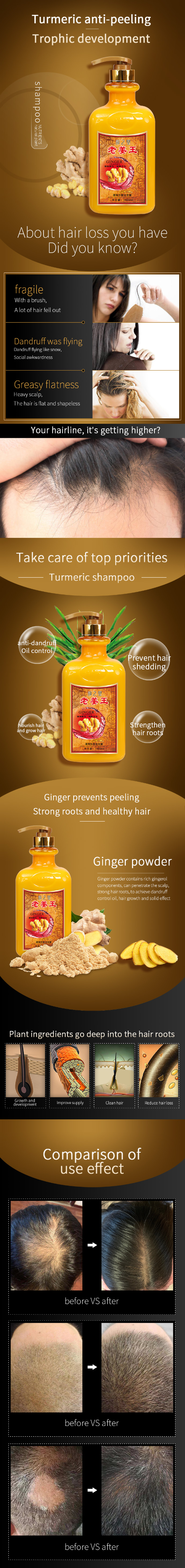 Private Label 1000ml Ginger Anti Hair Loss Hair Growth Shampoo Anti Dandruff Repairing Nourishing Beauty for Women Products from China supplier