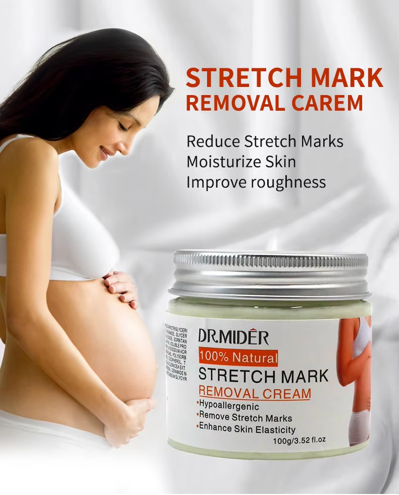High Quality Powerful Stretch Marks Remover Skin Repair Cream Treatment Scar Removal Pregnancy Cream Adults GMP Moisturizer 1pcs from China supplier