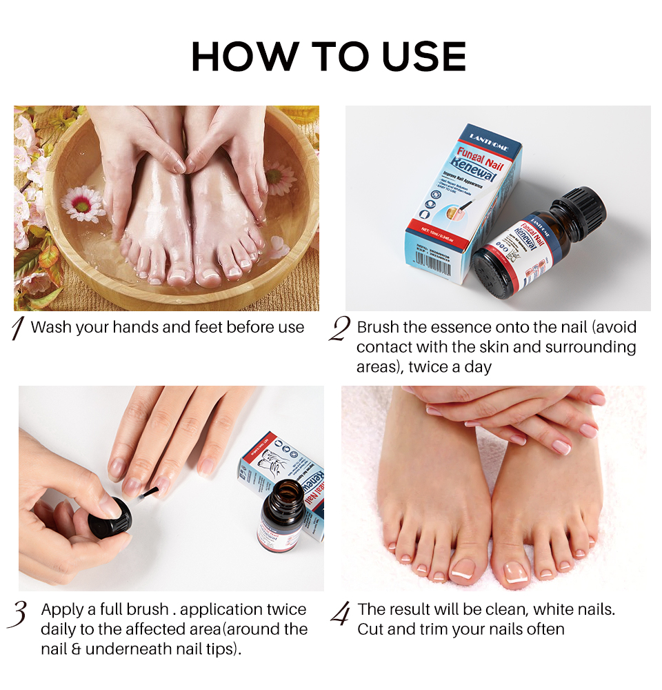 OEM/ODM Herbal Anti Fungal Nail Infection Foot Toe Nail with Fungus Treatments Oil Liquid  for Fungal Nail from China supplier