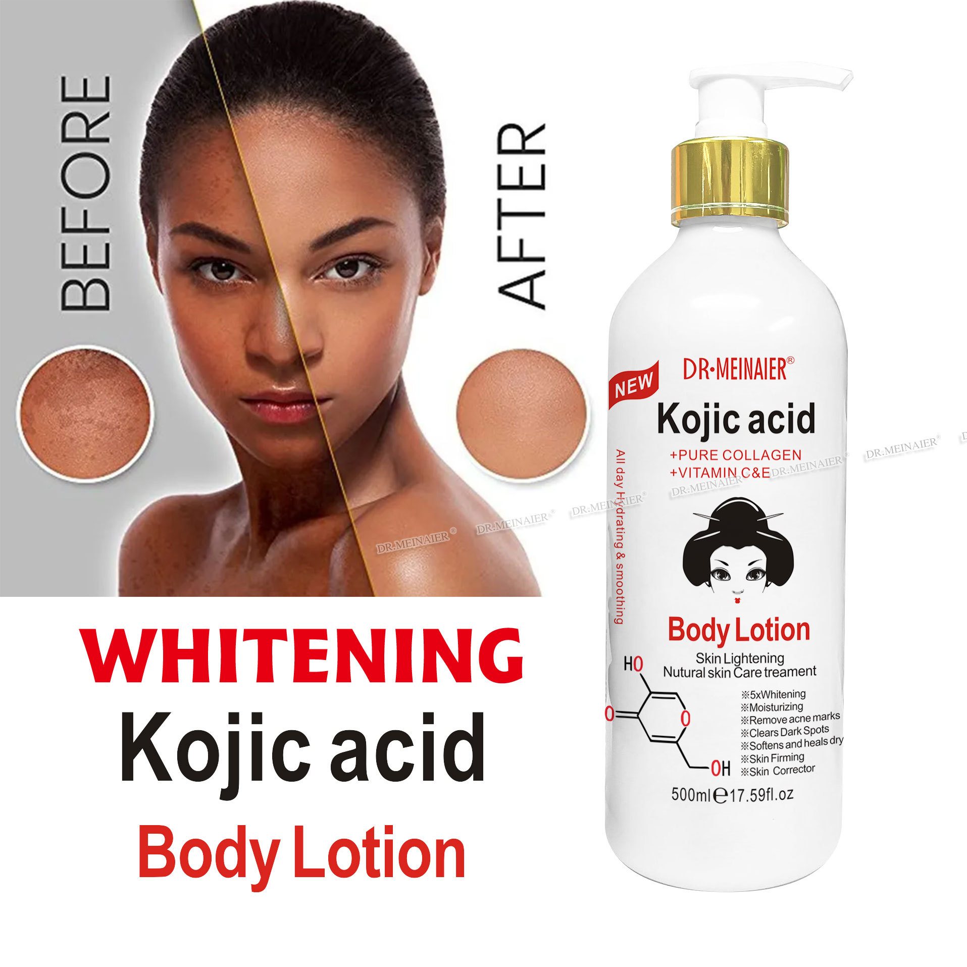 Private Logo Kojic Acid Body Whitening Lotion Moisturizing Anti Aging Face Lotion Nourishing Brightening Body Milk Products from China supplier