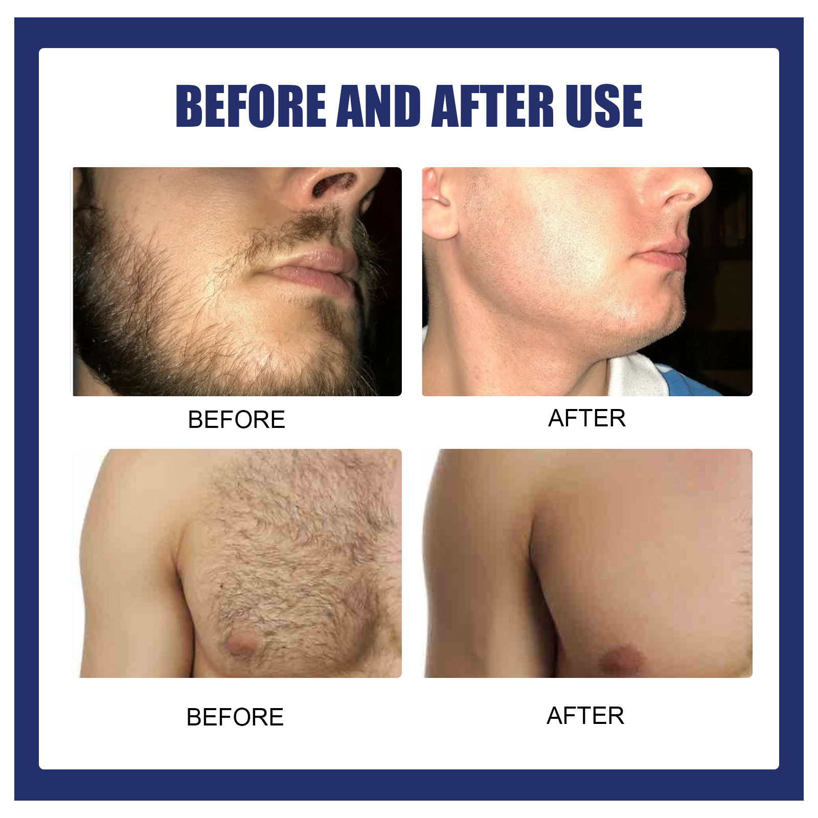 High Quality Fsat Men Beard Armpit Chest Body Fast Hair Removal Cream Gentle Hair Removal Delays Hair Growth from China supplier