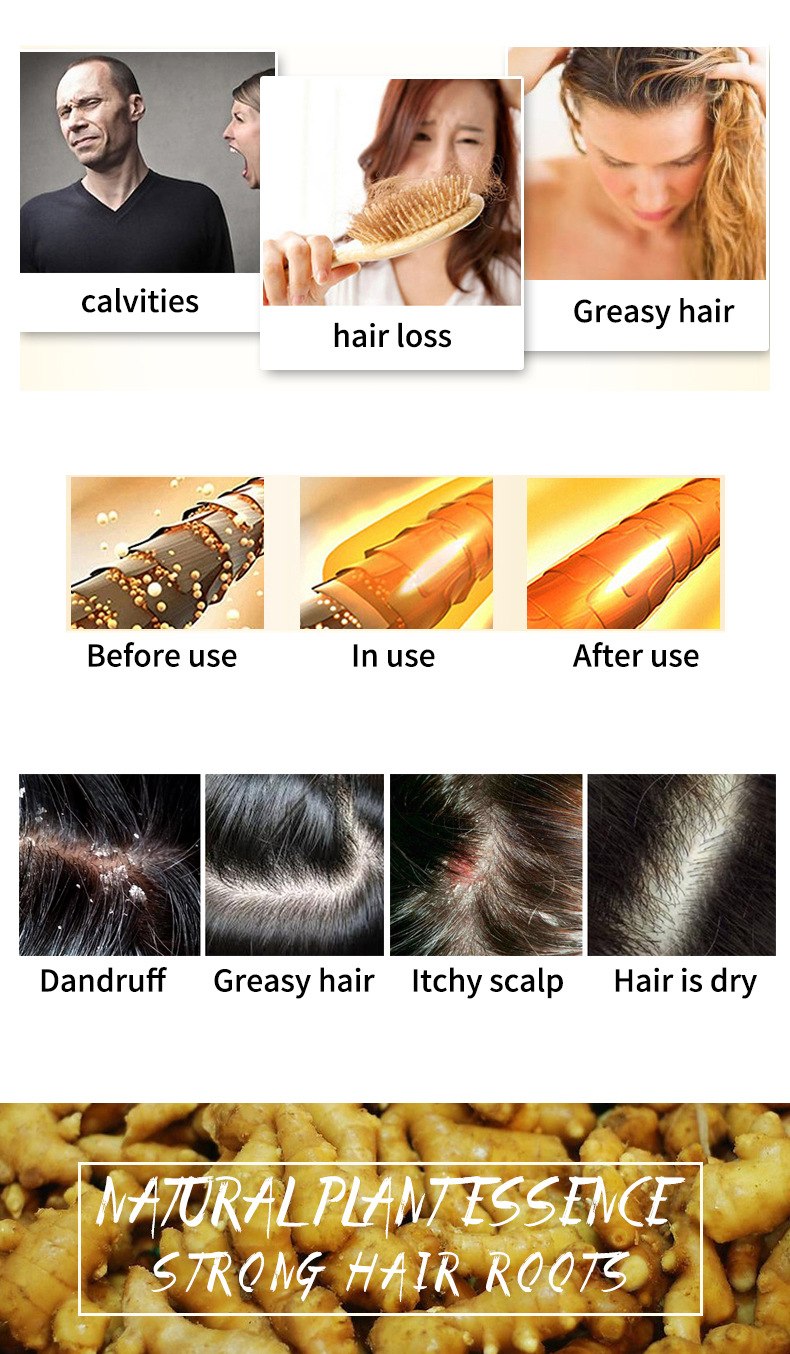 Private Label Organic Ginger Hair Regrowth Shampoo Bar Pure Plant Handmade Soap 16 Flavours Anti Hair Loss Oil Shampoo Soap from China supplier