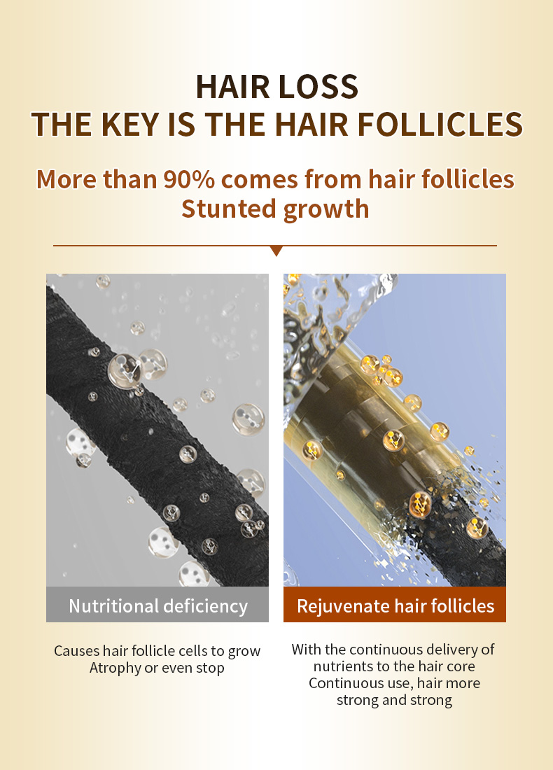 Factory Direct 500ml Herbal Hair Shampoo Hair Loss Treatment Shampoo Organic Turmeric Hair Loss Products from China supplier