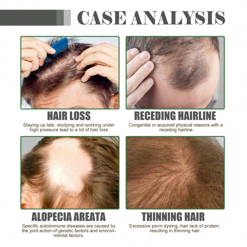 Private Label  Hair Care Essence Scalp Massage Serum Moisturizing Supple Plump and Nutritious Hair Care for Hair Growth from China supplier