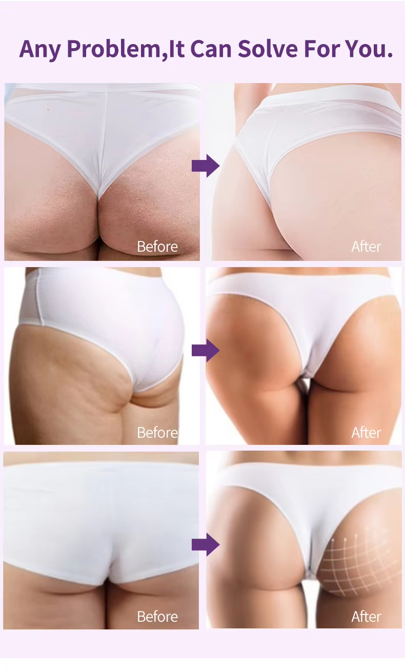 OEM Custom Butt Lifting Cream Organic Butt Skin Care Products Breast Enlargement Butt Enhancement Cream Beauty Products from China supplier