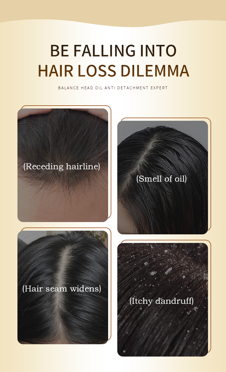 Factory Direct 500ml Herbal Hair Shampoo Hair Loss Treatment Shampoo Organic Turmeric Hair Loss Products from China supplier