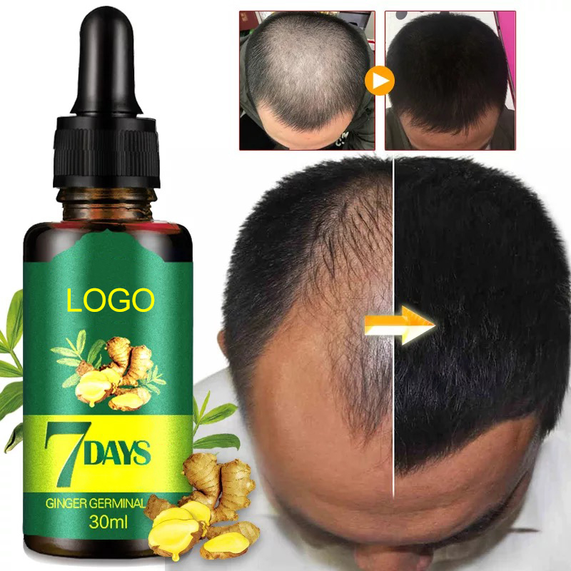 Ready to Ship Private Label Men's Ginger Germinal Serum Oil Anti Hair Loss Treatment Hair Growth Oil from China supplier