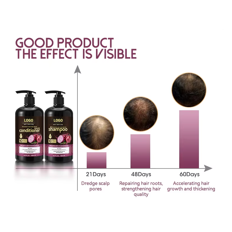 Oem Private Label Anti-Loss Hair Care Women'S Onion Shampoo and Conditioner Set from China supplier