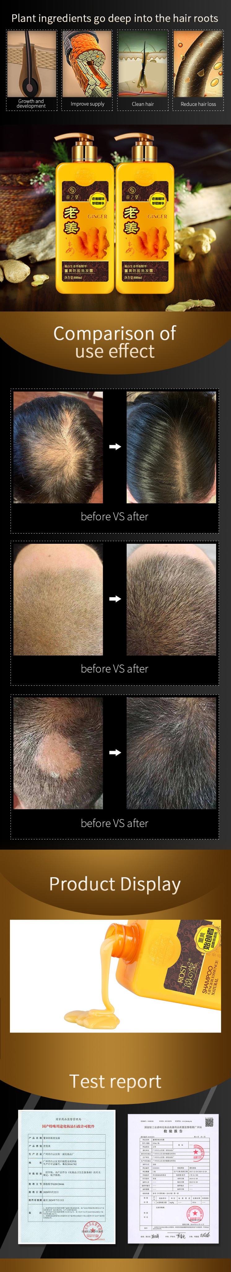 Private Logo Natural Ginger Serum Anti Hair Loss Anti-Dandruff Nourishing Growth Turmeric Shampoo Moisturizing Cream Products from China supplier